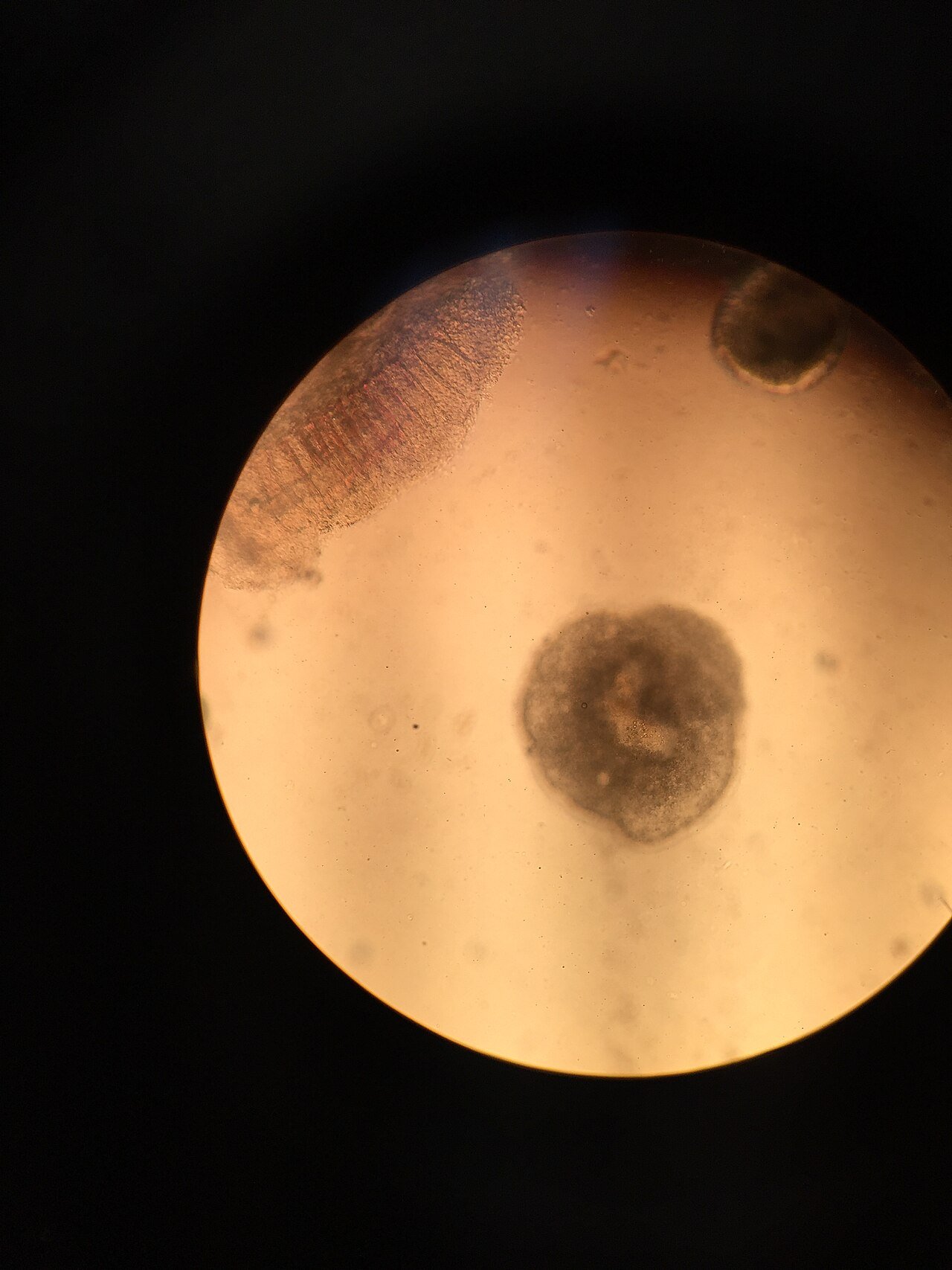 Ichthyophthirius multifiliis parasite seen under a microscope